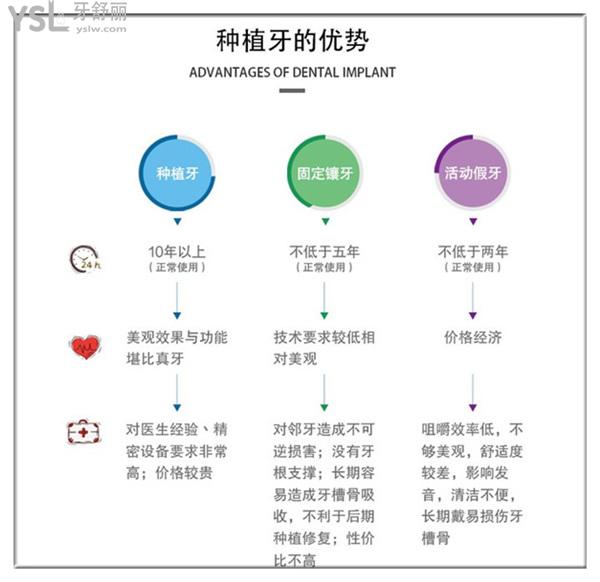 北京金圣口腔種植牙優(yōu)勢