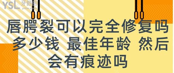 唇腭裂可以完全修復(fù)嗎 多少錢.jpg