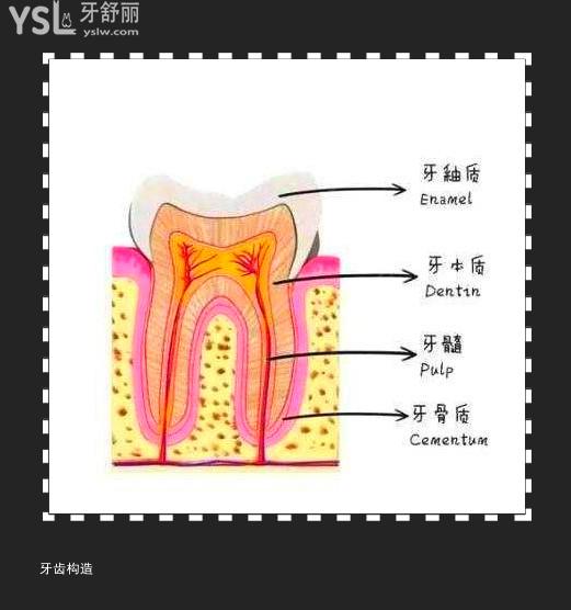隱裂牙是保還是拔
