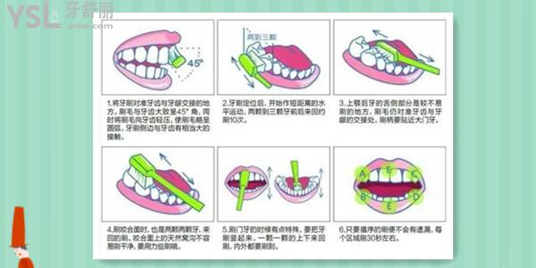 牙齦發(fā)炎了怎么自己處理.jpg
