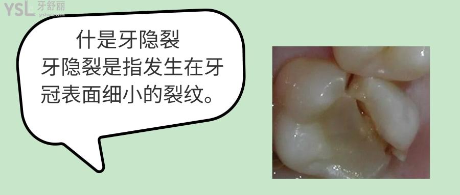 隱裂牙癥狀會(huì)引起頭痛嗎.jpg