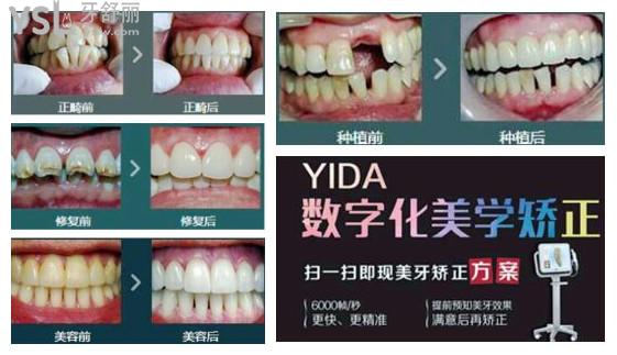 蘇州看牙好的牙科醫(yī)院排名