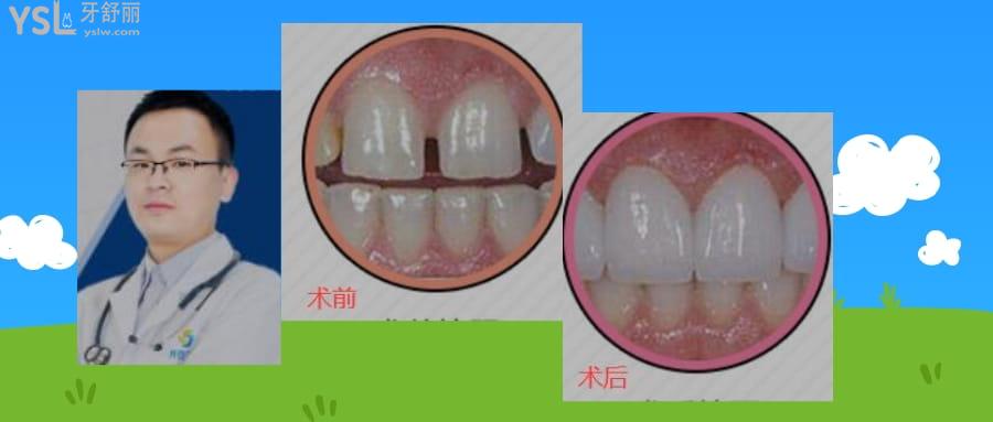 北京蘇亞醫(yī)療美容醫(yī)院牙齒美容中心怎么樣