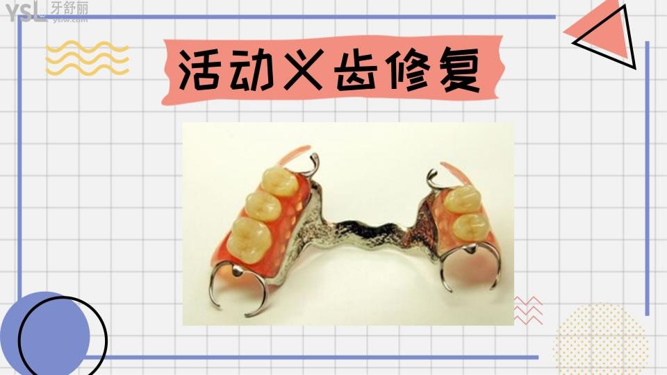 牙齒修復(fù)的幾種方法和價(jià)格如何呢 .jpg