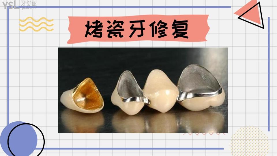 牙齒修復(fù)的幾種方法和價(jià)格如何呢 .jpg