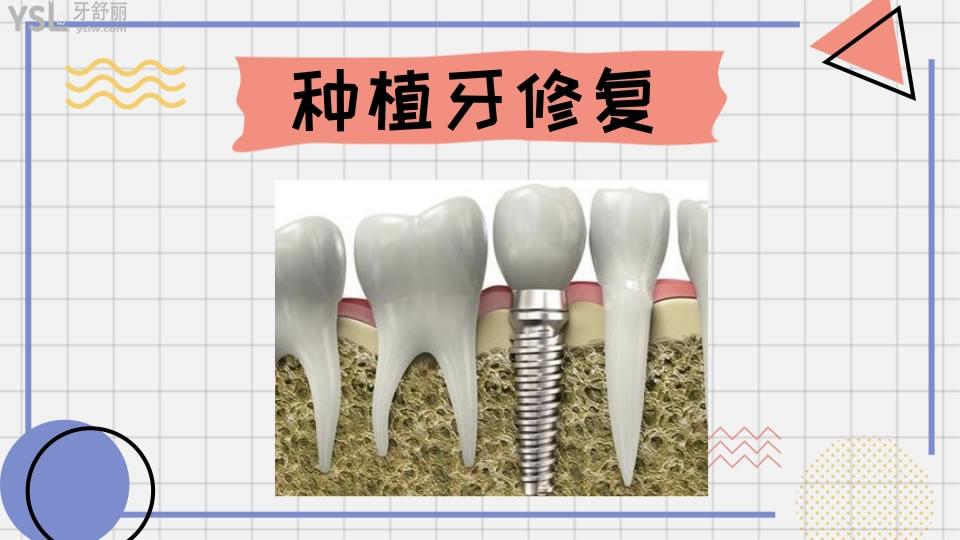牙齒修復(fù)的幾種方法和價(jià)格如何呢 .jpg