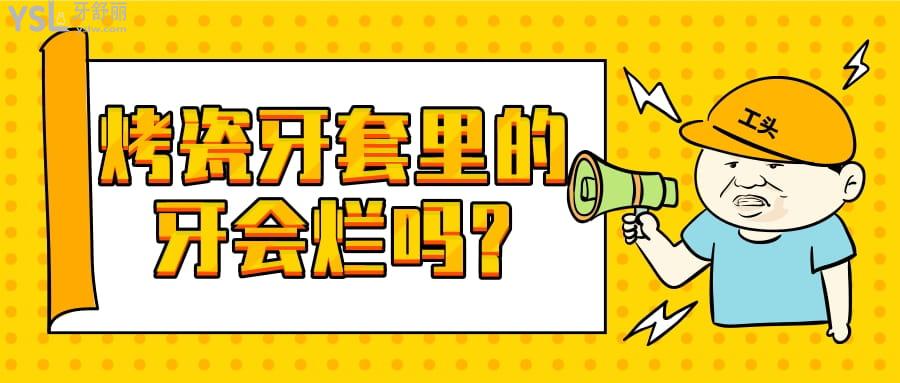 烤瓷牙套里的牙會(huì)爛嗎?