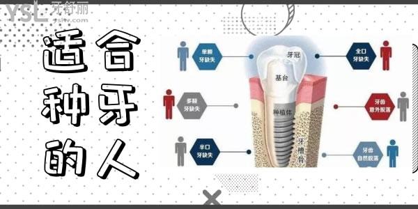 株洲做1顆種植牙的市場價格是多少錢.jpg