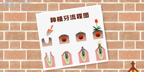株洲做1顆種植牙的市場價格是多少錢.jpg