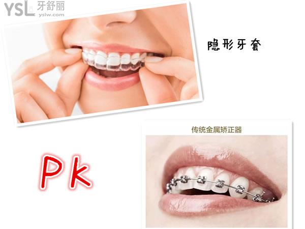 金屬牙套和隱形牙套對比