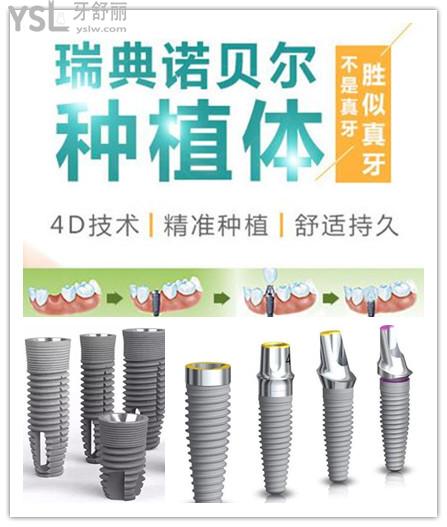 2021年瑞典諾貝爾種植牙全系列價(jià)格表 與瑞士ITI.jpg