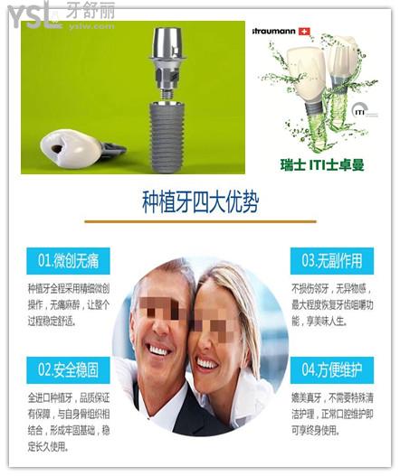 2021年瑞典諾貝爾種植牙全系列價(jià)格表 與瑞士ITI.jpg