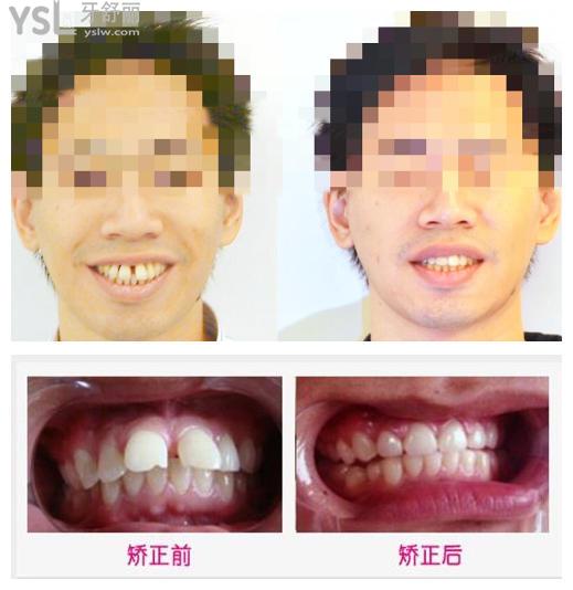 矯正成效