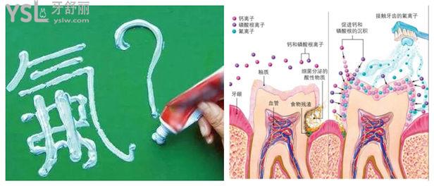什么牌子的牙膏固齒好