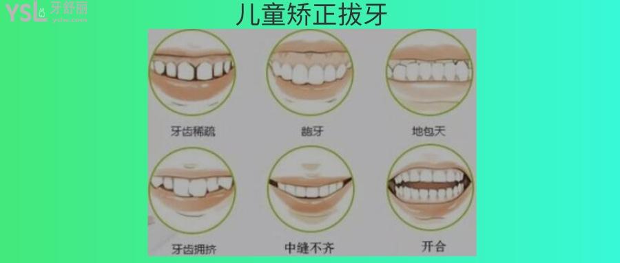 兒童正畸拔牙的危害