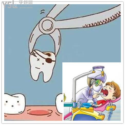 青少年牙齒矯正需要拔牙嗎