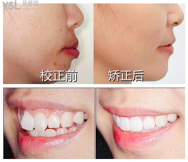 矯正成效