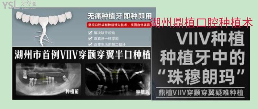 湖州鼎植口腔醫(yī)院
