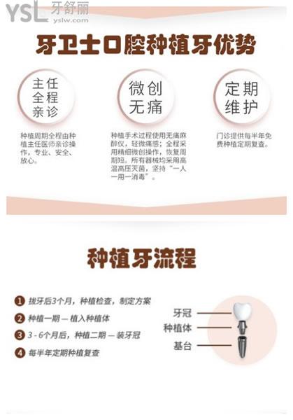 牙衛(wèi)士種植牙優(yōu)勢