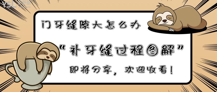 補牙縫過程圖解