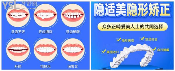 隱適美矯正優(yōu)勢(shì)