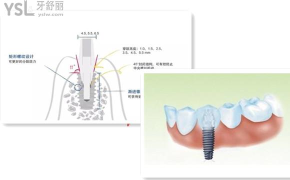 仕諾康質(zhì)量如何
