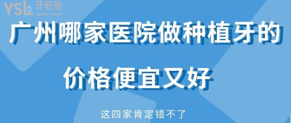 廣州哪家醫(yī)院做種植牙的價(jià)格便宜又好 這四家肯定錯(cuò)不了