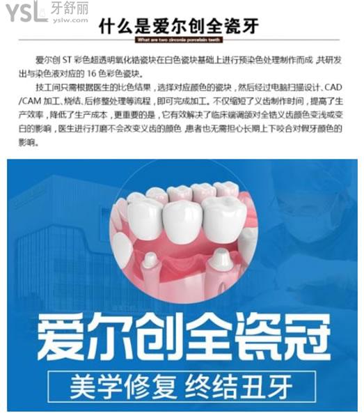 國(guó)產(chǎn)愛爾創(chuàng)全瓷牙