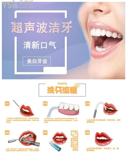 洗牙過程
