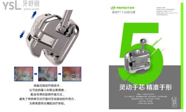 普特自鎖托槽矯正器優(yōu)勢