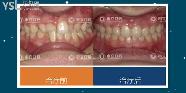 南寧市立口腔門診收費標(biāo)準(zhǔn)更新 親診患者說 醫(yī)生技術(shù)好價格便宜還能刷**.jpg