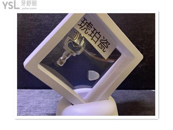 琥珀瓷貼面