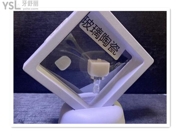 玻璃瓷貼面