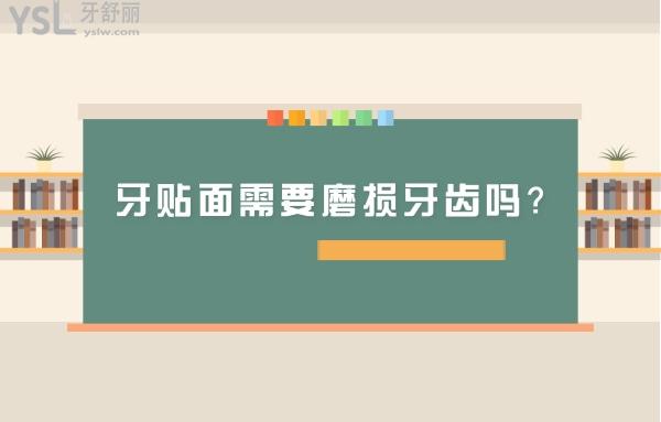 牙貼面