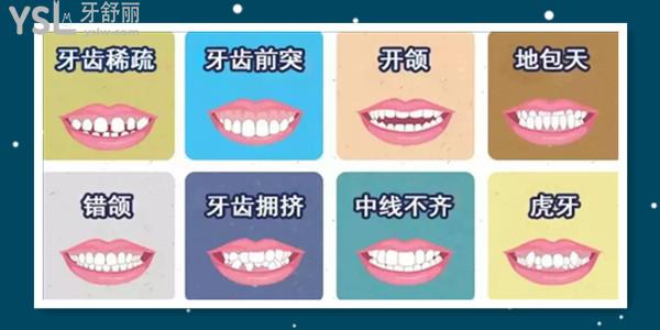 12歲兒童牙齒矯正費(fèi)用是多少 牙齒矯正時(shí)應(yīng)注意些什么呢.jpg