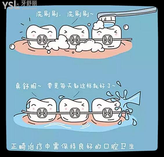 12歲兒童牙齒矯正費(fèi)用是多少 牙齒矯正時(shí)應(yīng)注意些什么呢.jpg