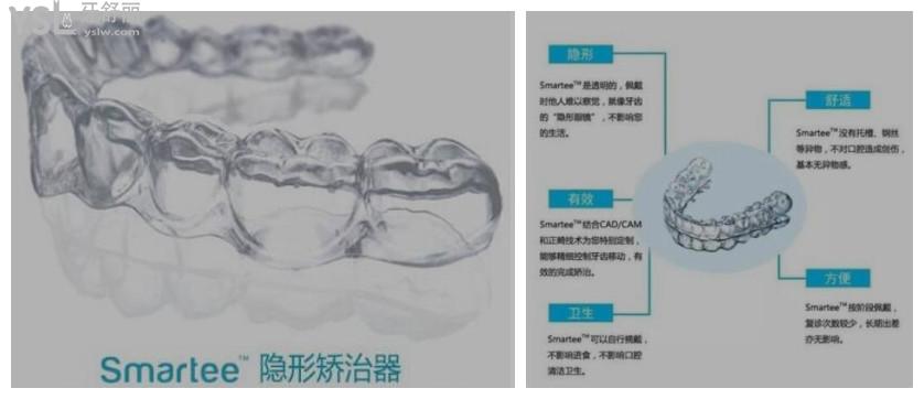 牙齒矯正隱形的什么品牌
