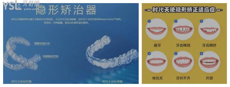 牙齒矯正隱形的什么品牌