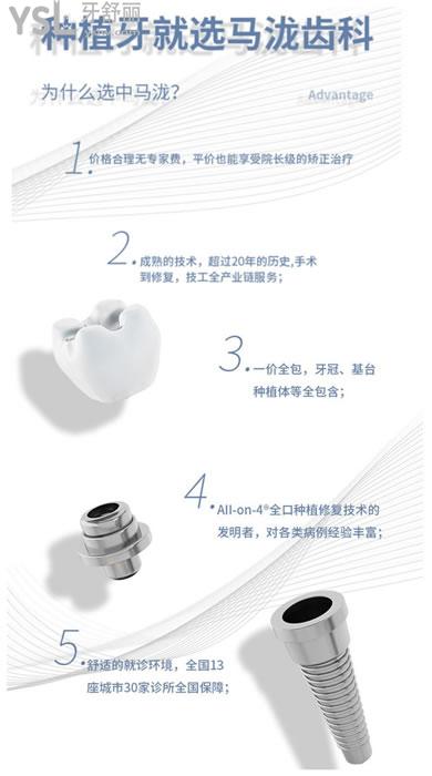 馬瀧齒科種植牙技術(shù)