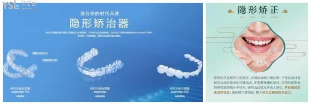 時(shí)代天使隱形牙套價(jià)格明細(xì)