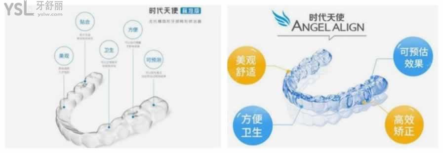 時(shí)代天使隱形牙套價(jià)格明細(xì)