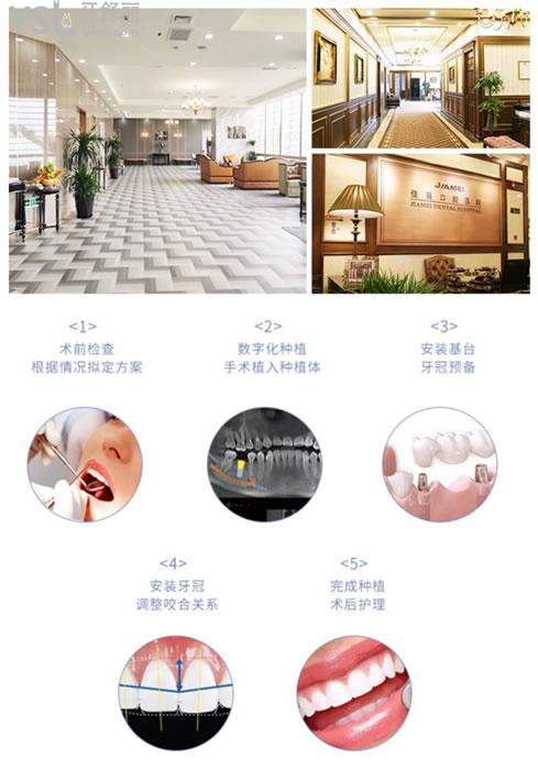 北京佳美口腔種植牙流程