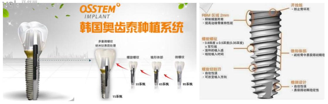 韓國奧齒泰和美國皓圣