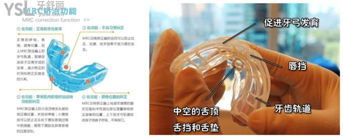 MRC肌功能矯治器