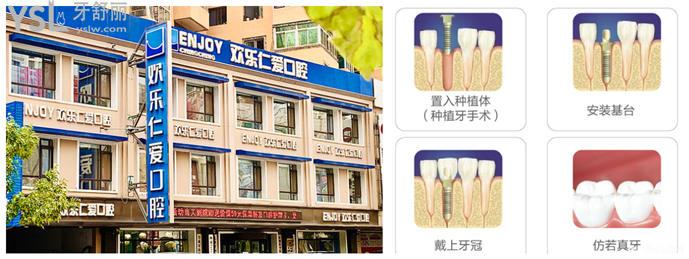 沈陽鑲全口牙價格