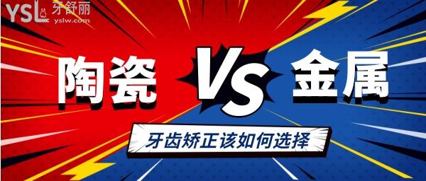 陶瓷自鎖和金屬自鎖哪個好 價格及優(yōu)缺點分別什么 該如何選擇.jpg