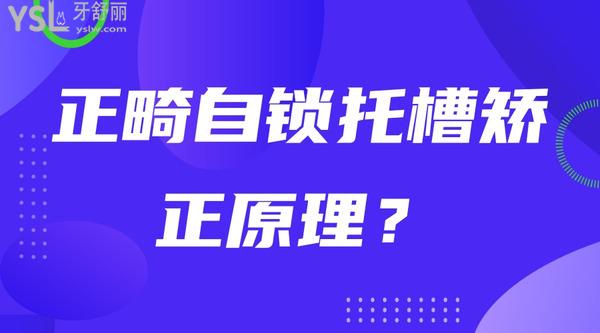 正畸自鎖托槽矯正原理？