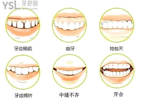 矯正器1_副本.jpg