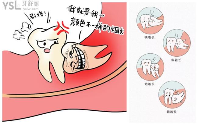 智齒圖