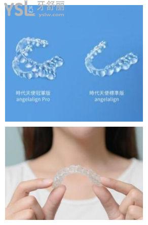 隱形牙套好還是鋼牙套好
